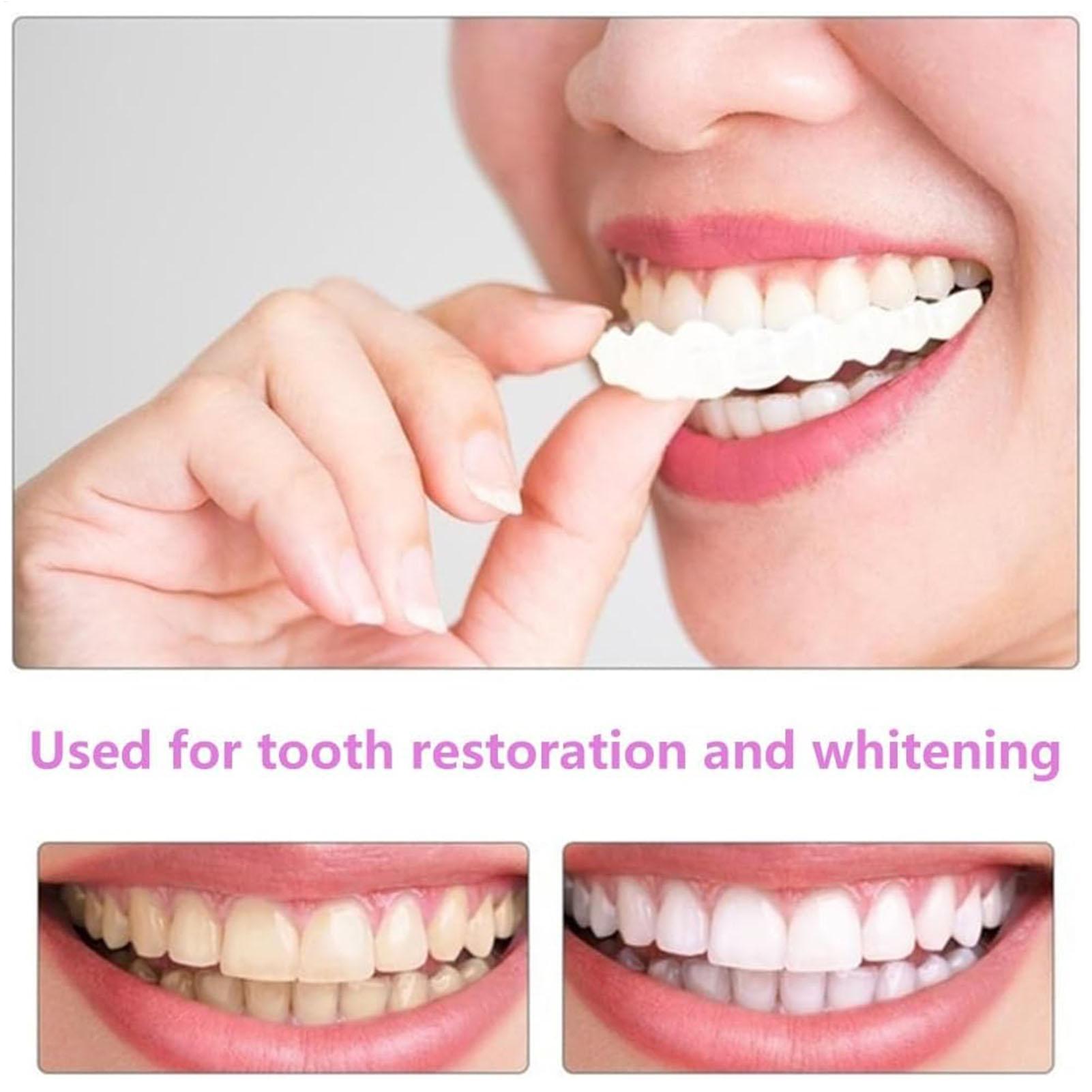 1pair Long-Term Veneers Teeth  - Teeth Whitening Instant review and price