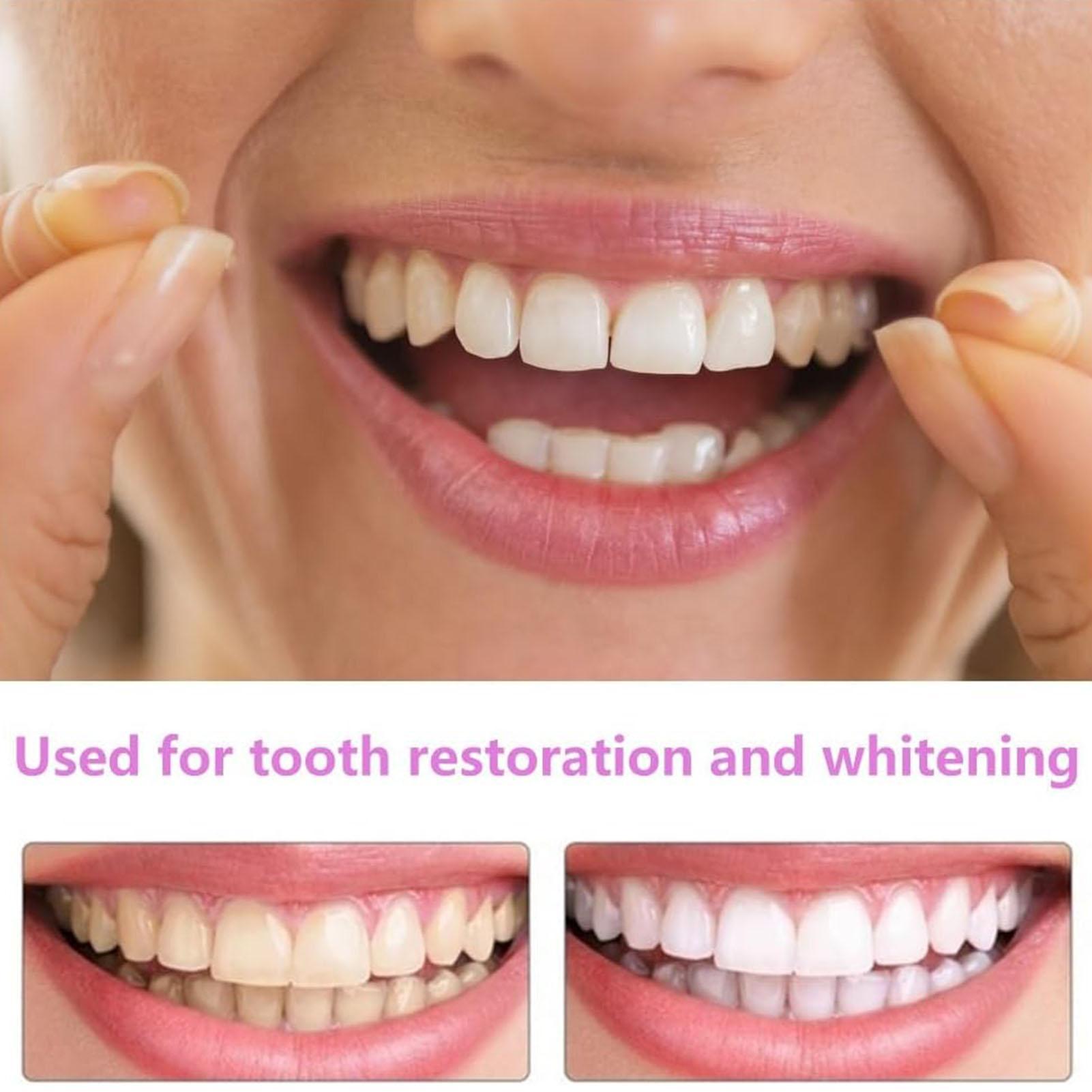 1pair Long-Term Veneers Teeth  - Teeth Whitening Instant review and price