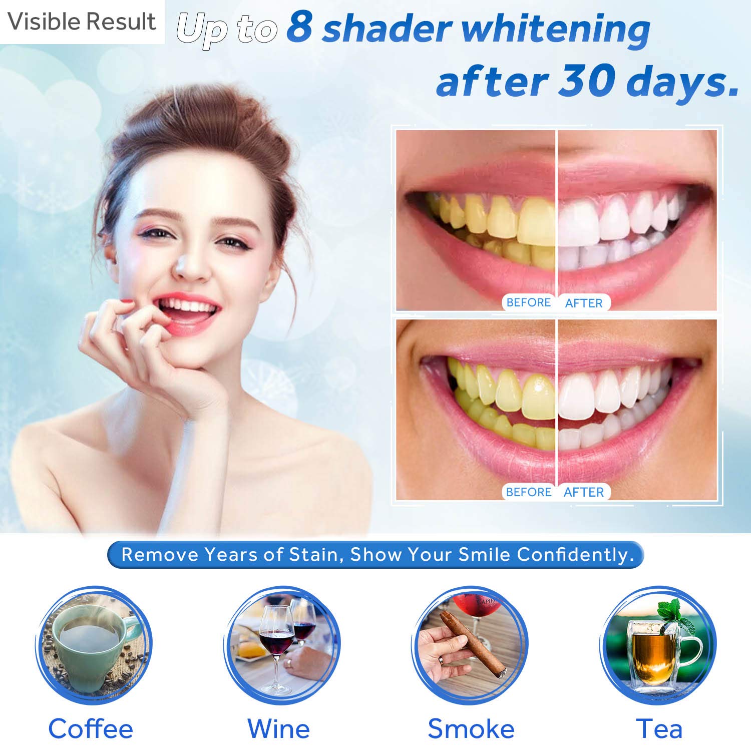 Teeth Whitening Gel Refill Syr - Teeth Whitening At Home review and price
