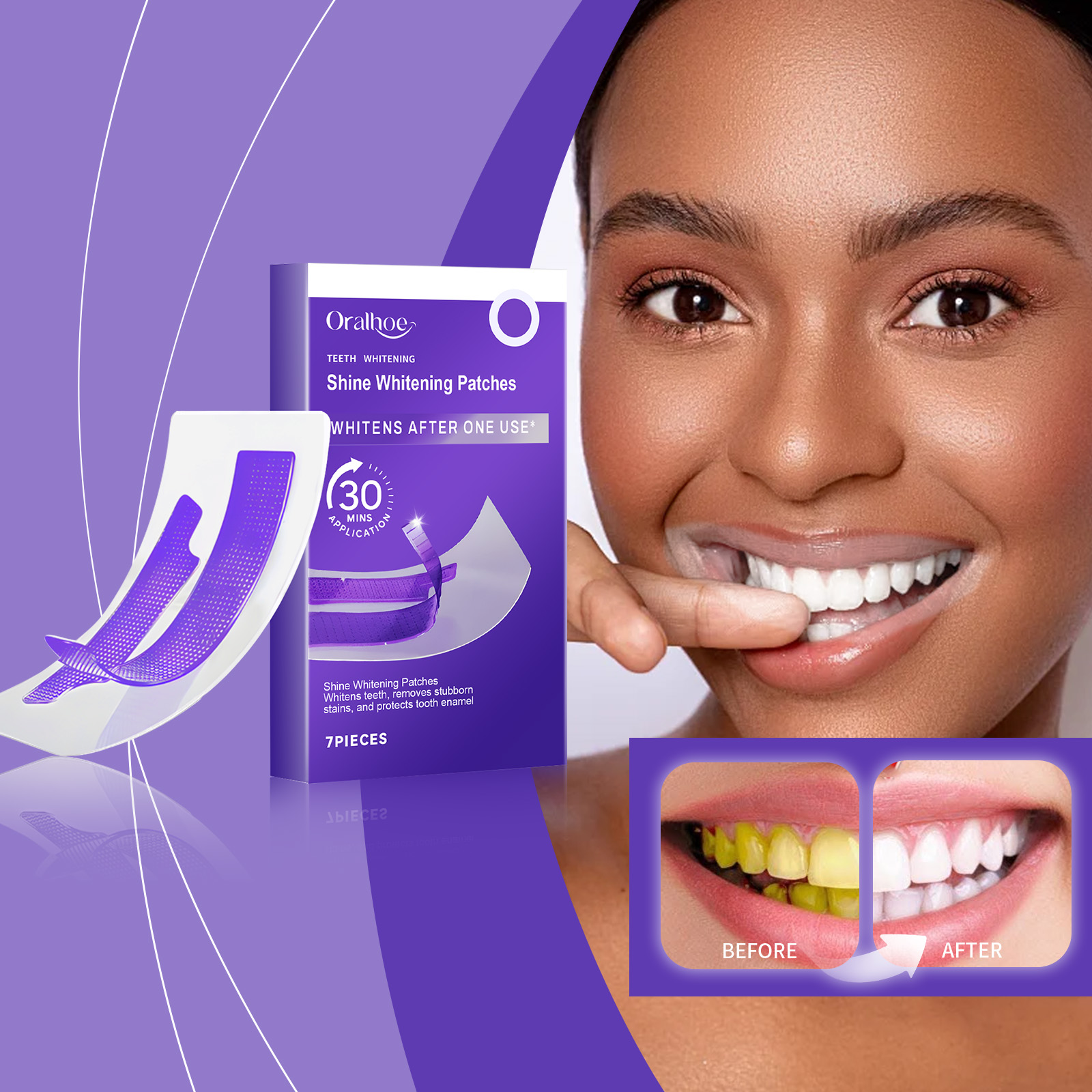 Purple Teeth Whitening Strips  - Teeth Whitening At Home review and price