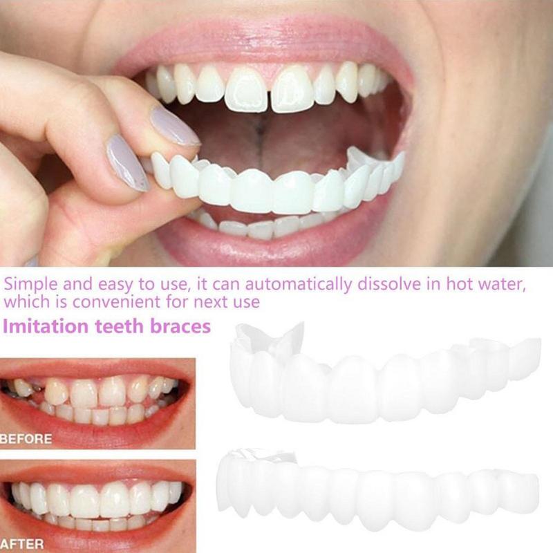 Snap On Teeth Veneers Instant  - Teeth Whitening Instant review and price