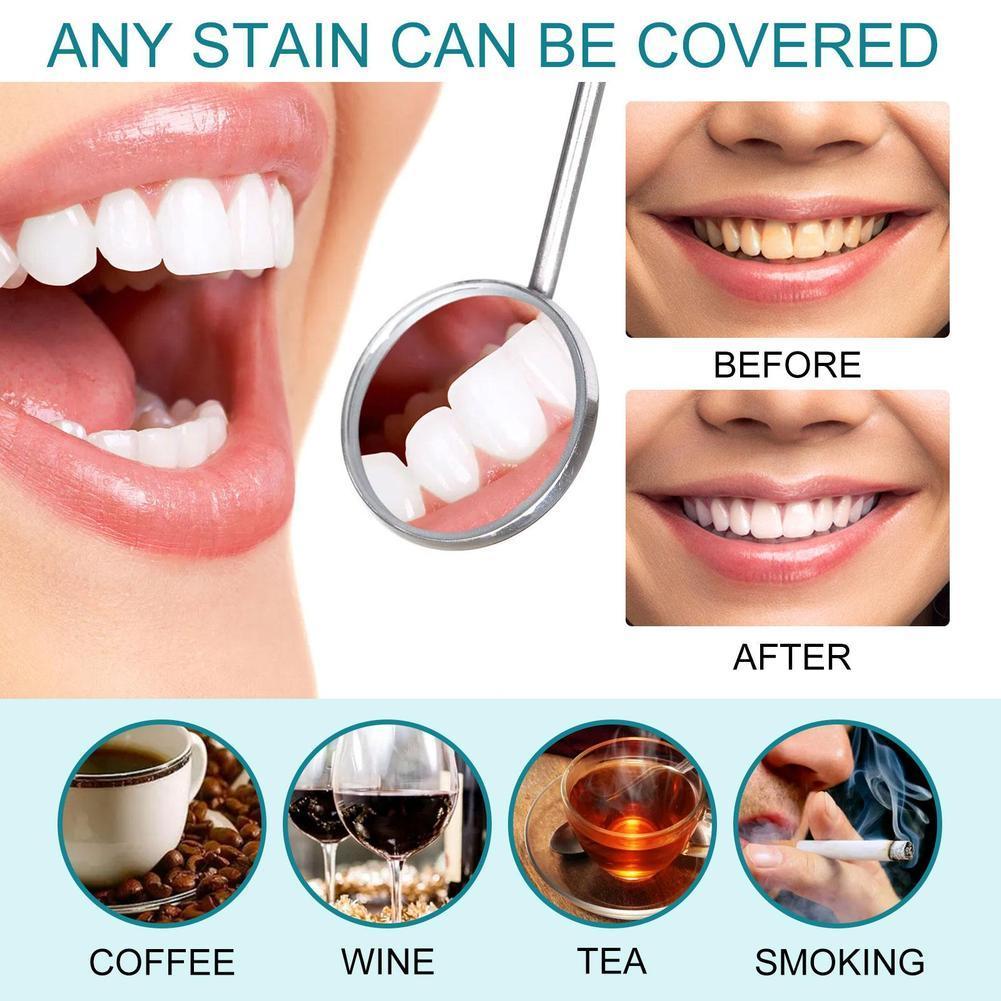Teeth White Paint Anti Pigment - Teeth Whitening Kit With Light review and price