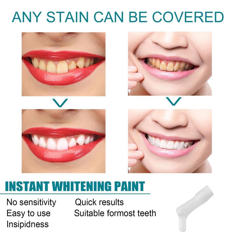 Teeth White Paint Anti Pigment - Teeth Whitening Kit With Light review and price