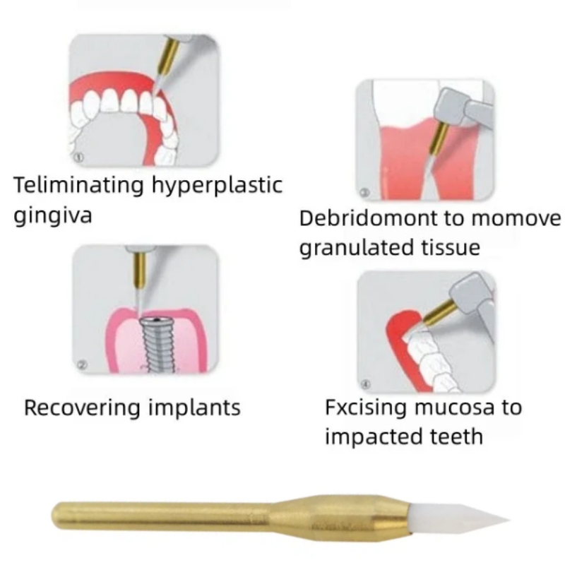 Dental Soft Trimmer Burs Surgi - Teeth Whitening Gum review and price