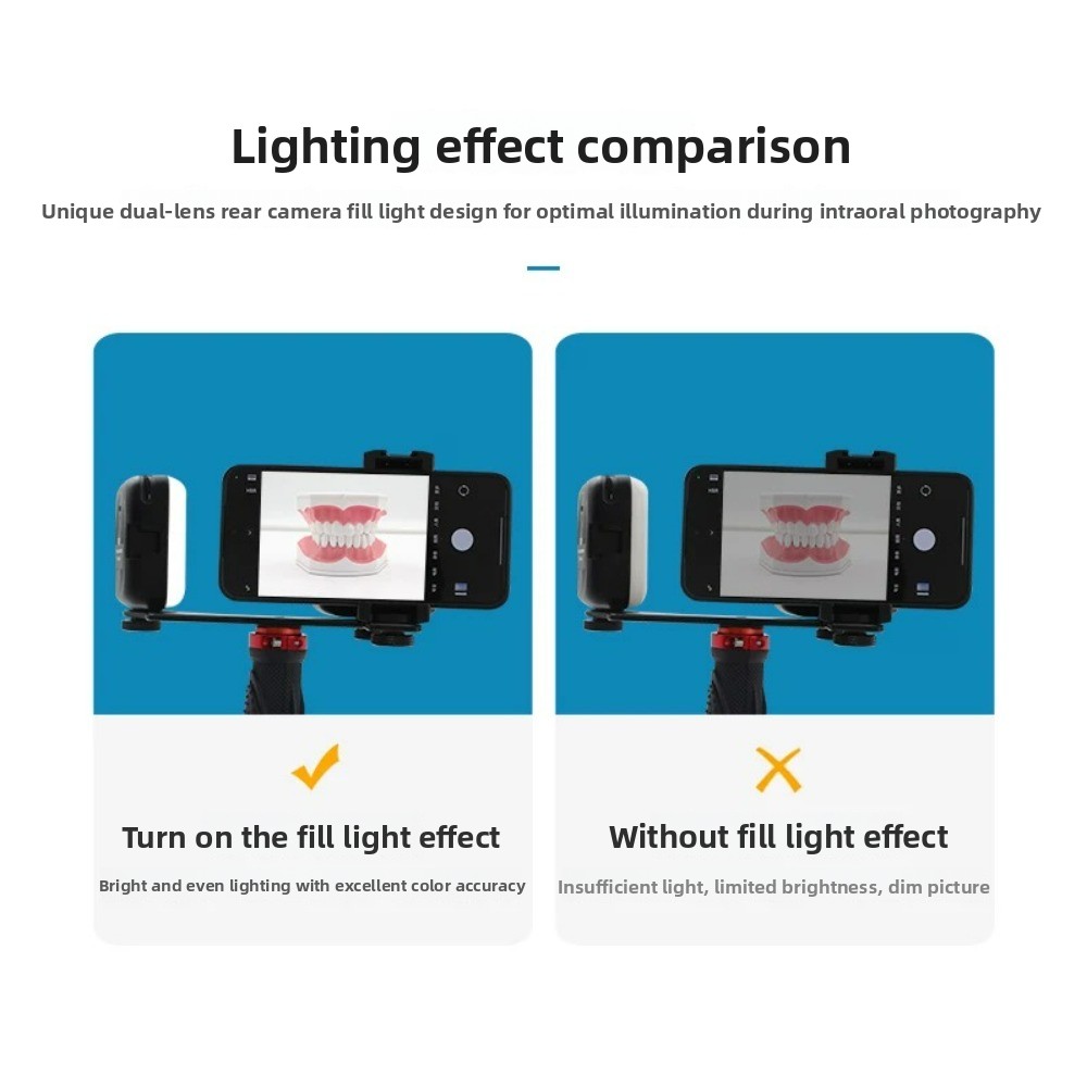 Dental Photography Light, Blue - Teeth Whitening Kit With Light review and price