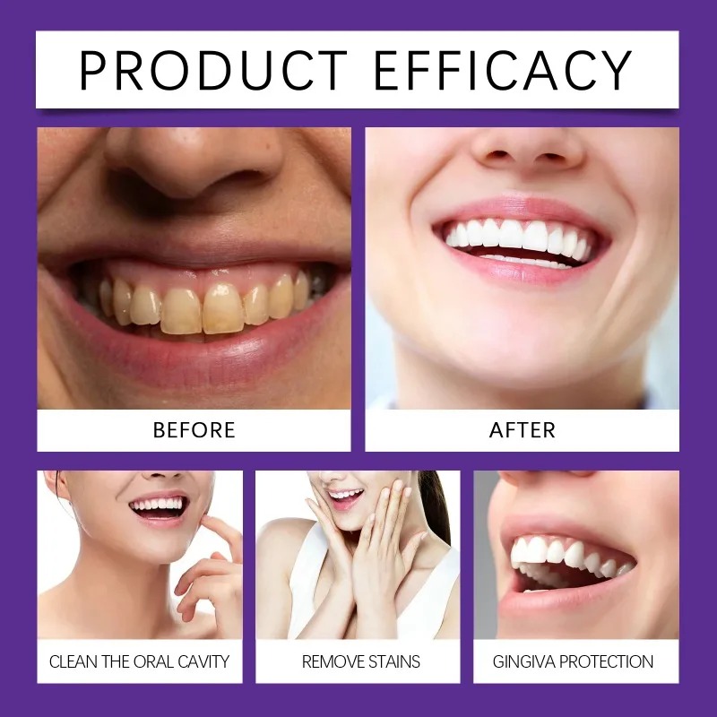 Purple Teeth Restoration Miner - Teeth Whitening Instant review and price