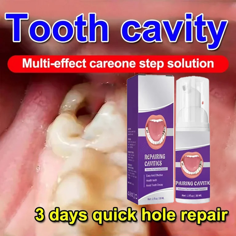 Teeth Cleaning Toothpaste Remo - Teeth Whitening Gum review and price