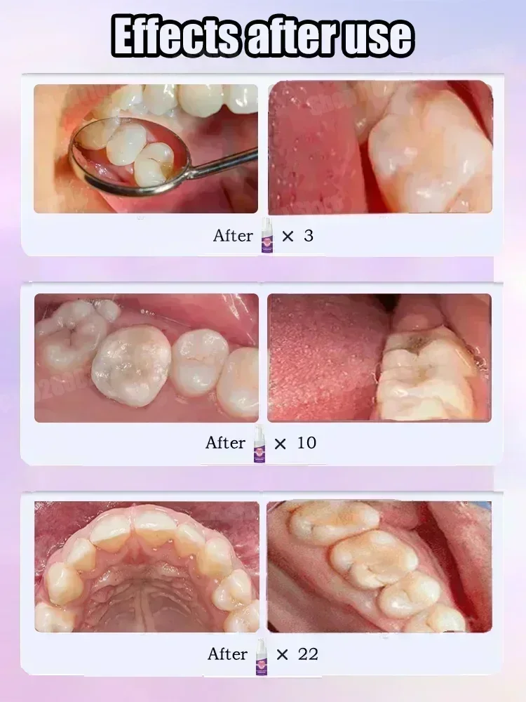 Teeth Cleaning Toothpaste Remo - Teeth Whitening Gum review and price
