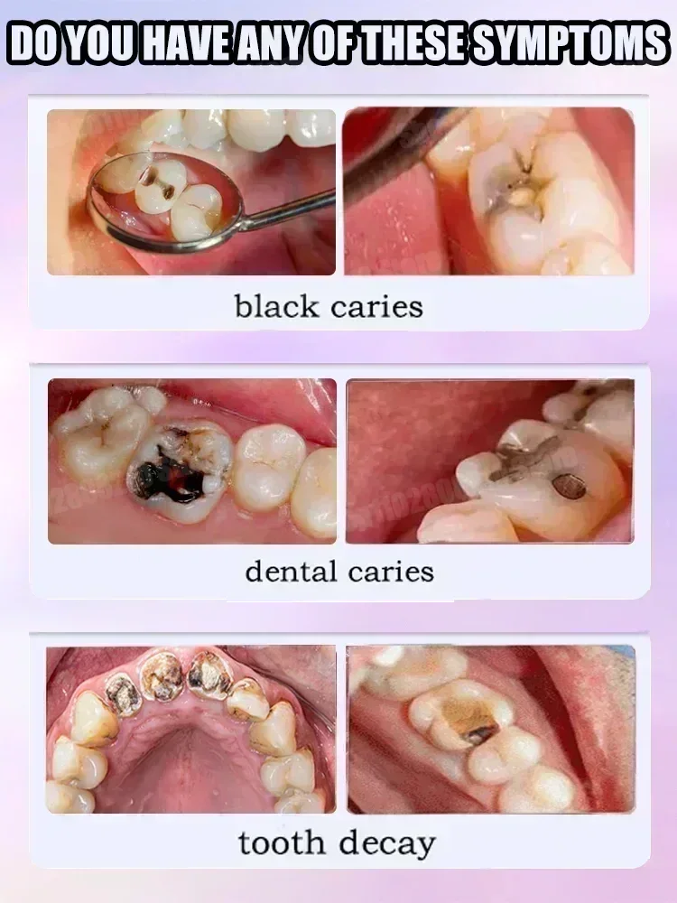 Teeth Cleaning Toothpaste Remo - Teeth Whitening Gum review and price