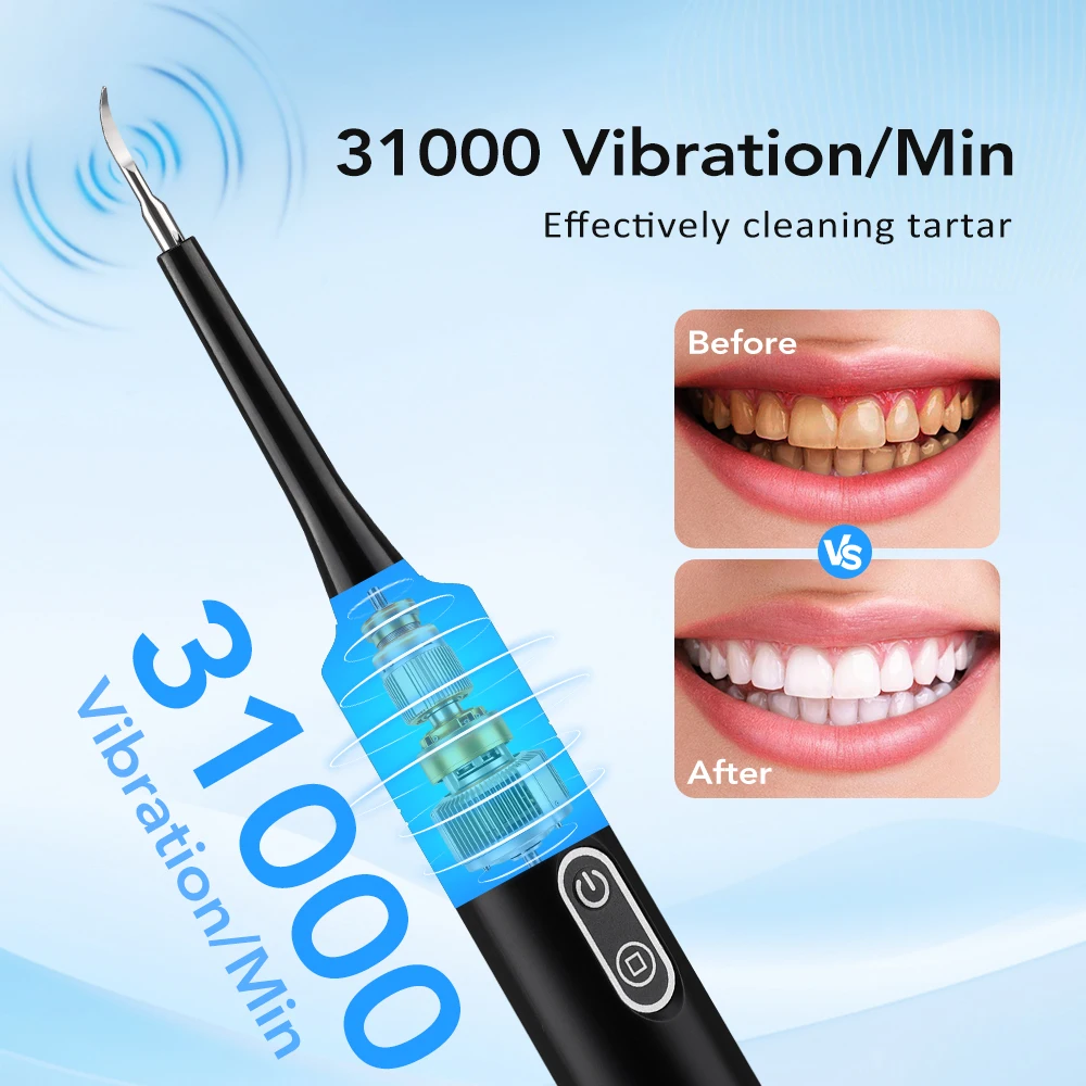 Electric Sonic Vibration Denta - Electric Toothbrush Sonic review and price